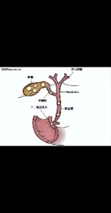 长春医科医院胆囊结石是疯狂的石头在作祟还是沉默的杀手在潜伏