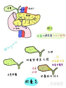 胆囊为啥总爱闹脾气这些习惯正在偷偷点火