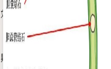胆总管里为啥总爱藏炸弹这些习惯竟是埋雷高手