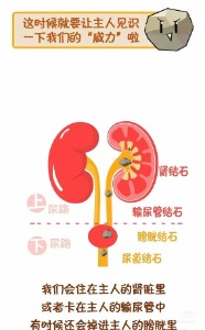 膀胱里为啥总爱卡石头这些习惯竟是造石帮凶