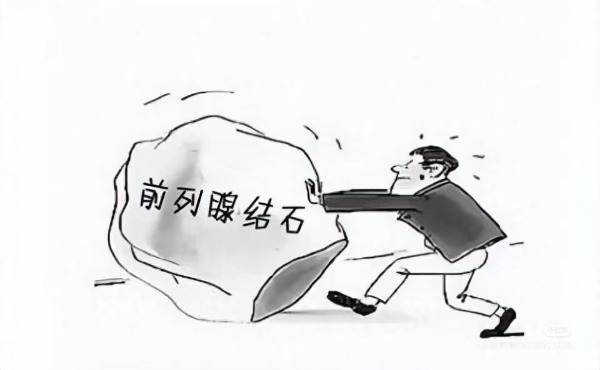 前列腺里为啥总爱藏鹅卵石这些习惯竟是幕后黑手