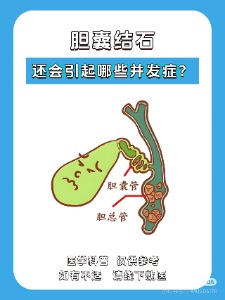 胆囊结石的代谢-循环-内环境自然调节体系