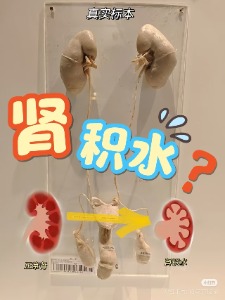 肾脏 智能水库 咋触发 水溢警报